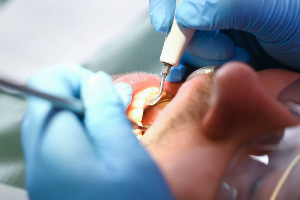 Best Emergency Dental Services for Seniors in Brown City, MI