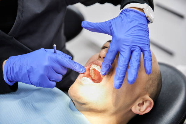 Best Emergency Dental Care for Abscessed Tooth in Brown City, MI